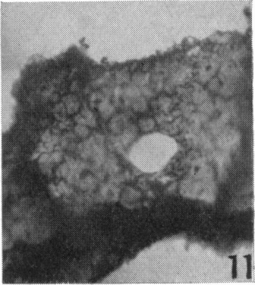 Fig. 11