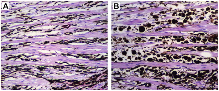 Fig. 12