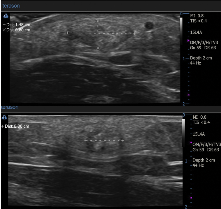 Fig 3