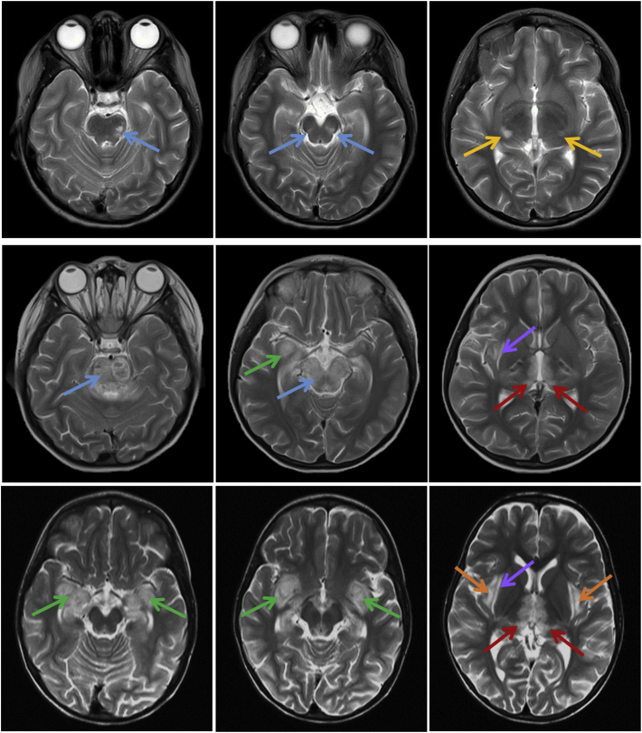 Fig. 2