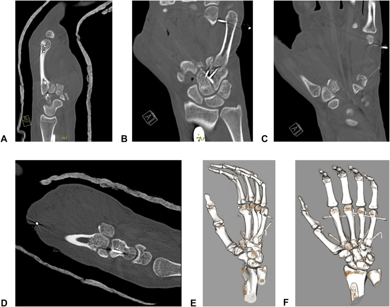 Figure 5