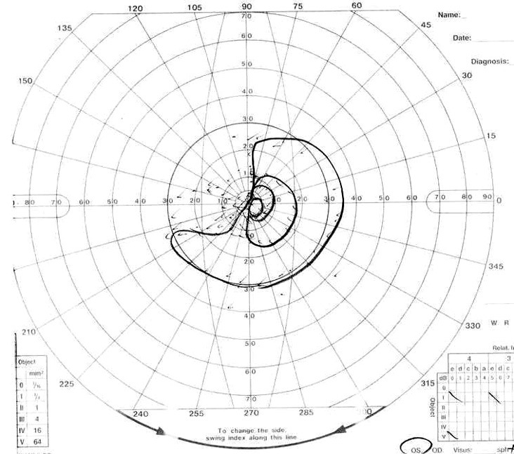 Fig. 1B