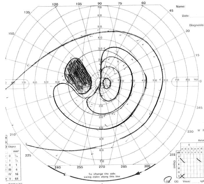 Fig. 1F