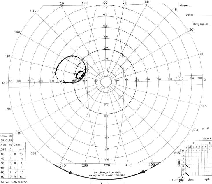 Fig. 1E