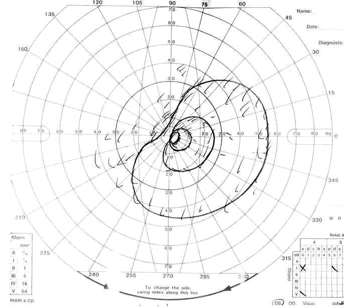 Fig. 1D