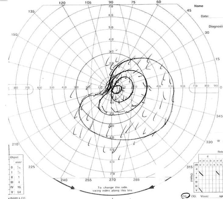 Fig. 1C