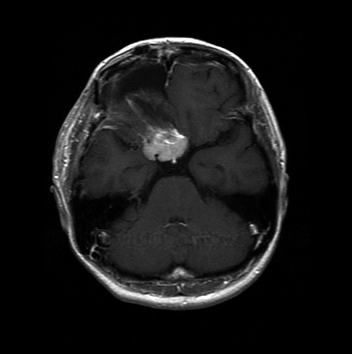 Fig. 2C