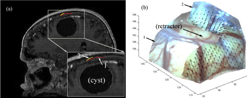 Fig. 12