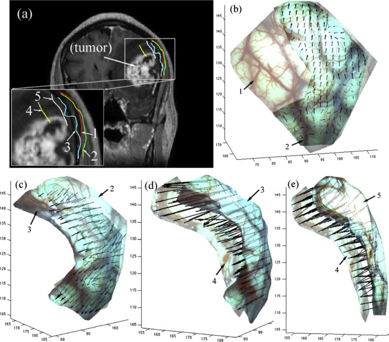 Fig. 11