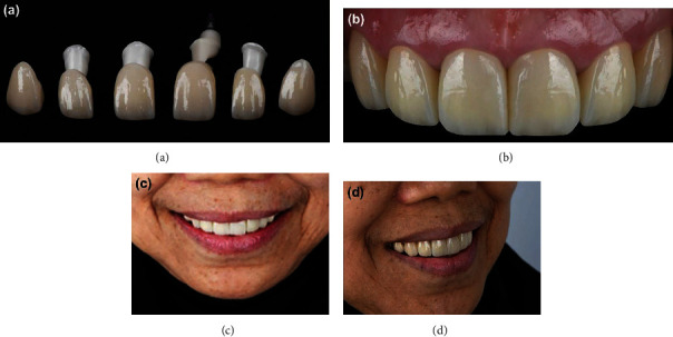 Figure 7