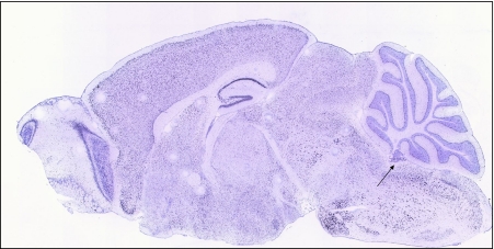 Fig. 2