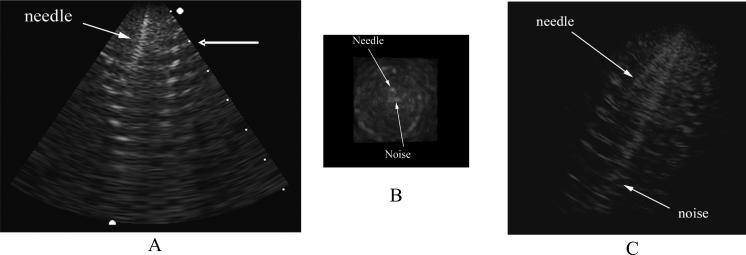 FIG. 11