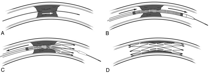 Fig 1.