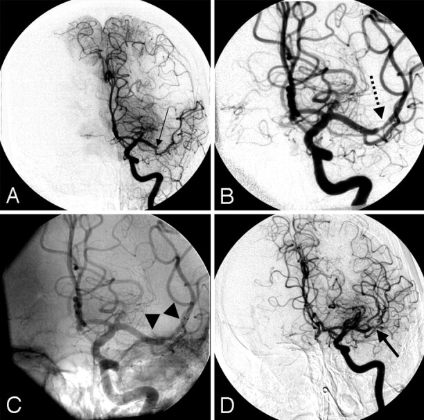 Fig 2.