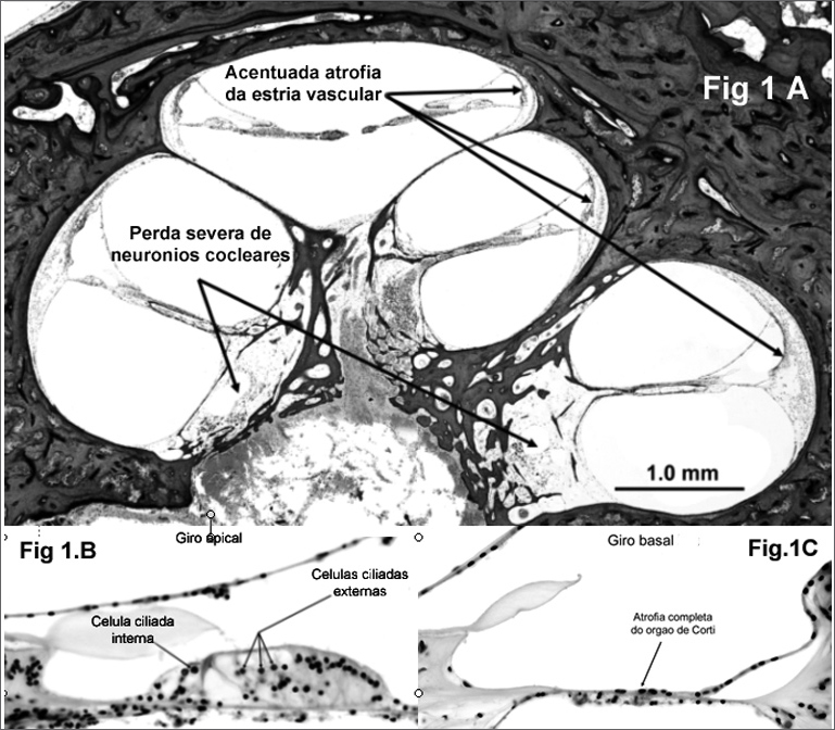 Figure 1A