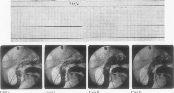 FIG. 5