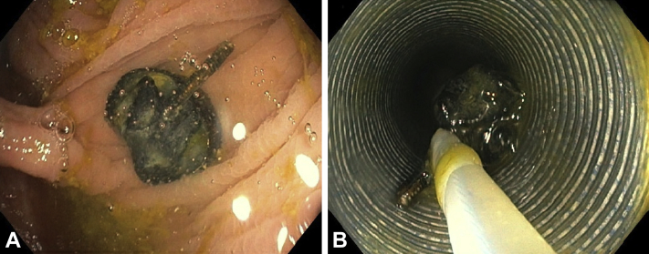 Figure 3