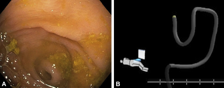 Figure 2