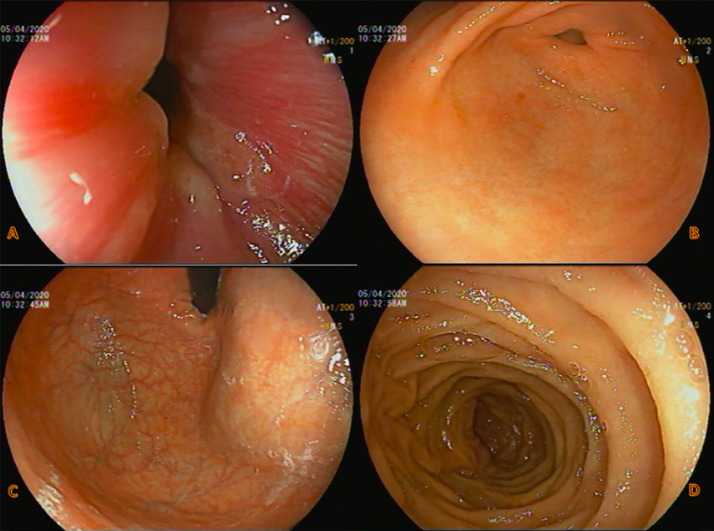 Fig. 2