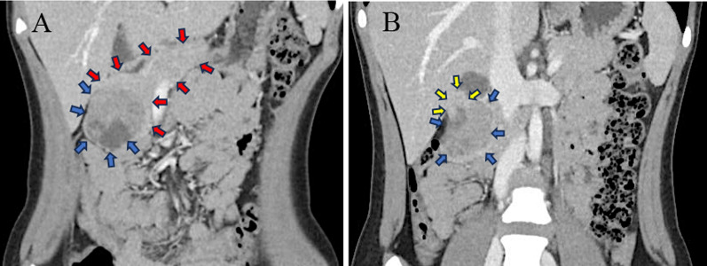 Fig. 1