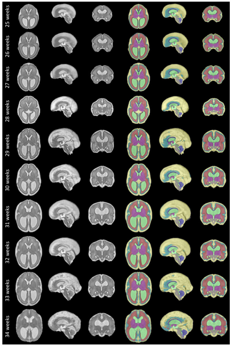 Figure 10. 