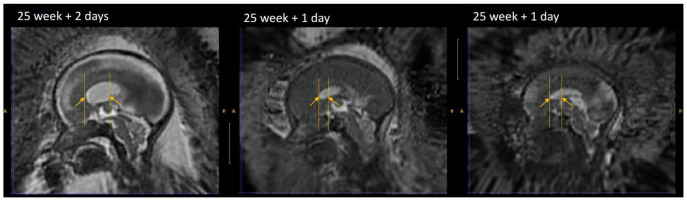 Figure 11. 