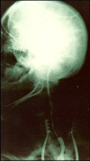 Figura 5