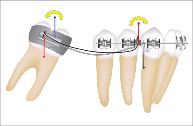 Figure 23