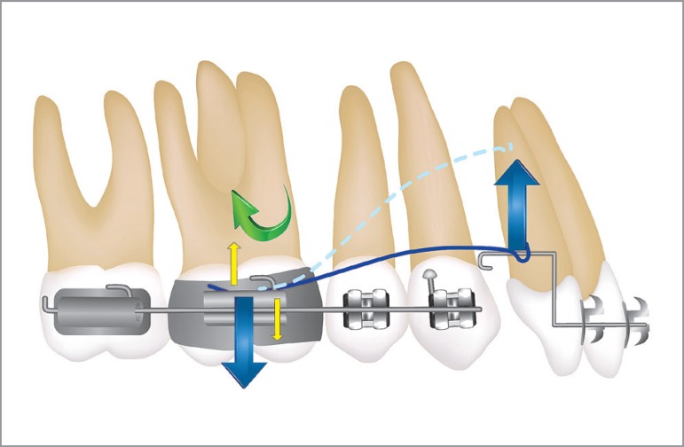 Figure 15