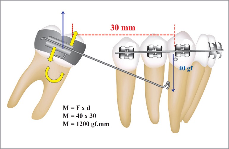 Figure 20