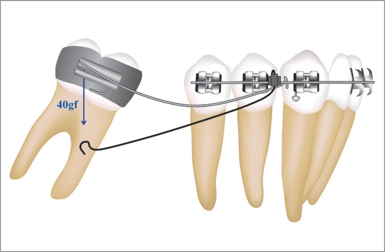 Figure 22