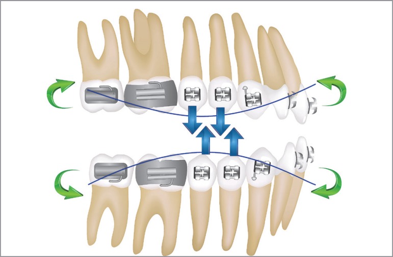 Figure 12