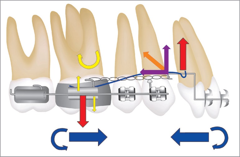 Figure 18