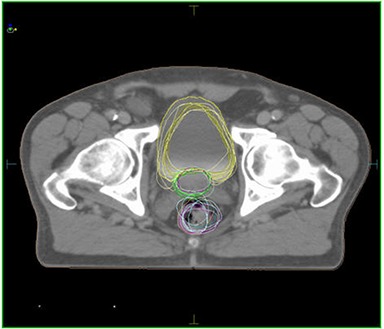 Figure 13