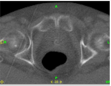 Figure 14(a)