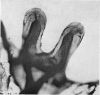 75