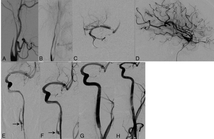 Fig 2.