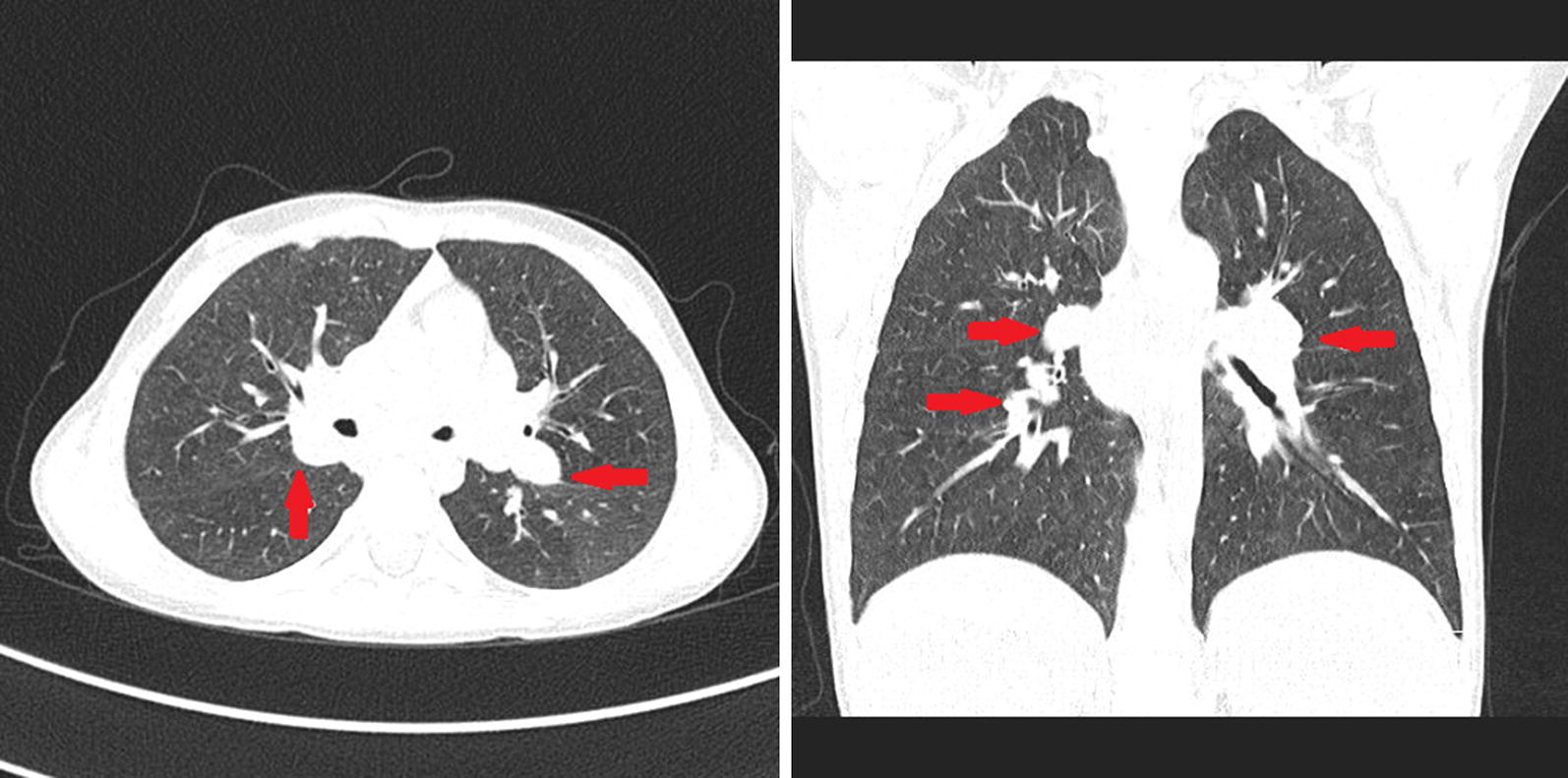 Fig. 1