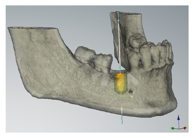 Figure 4