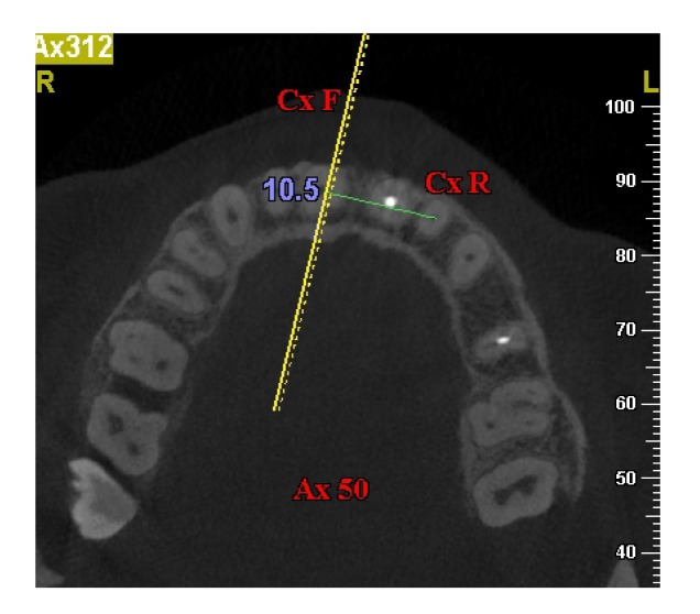 Fig. 5