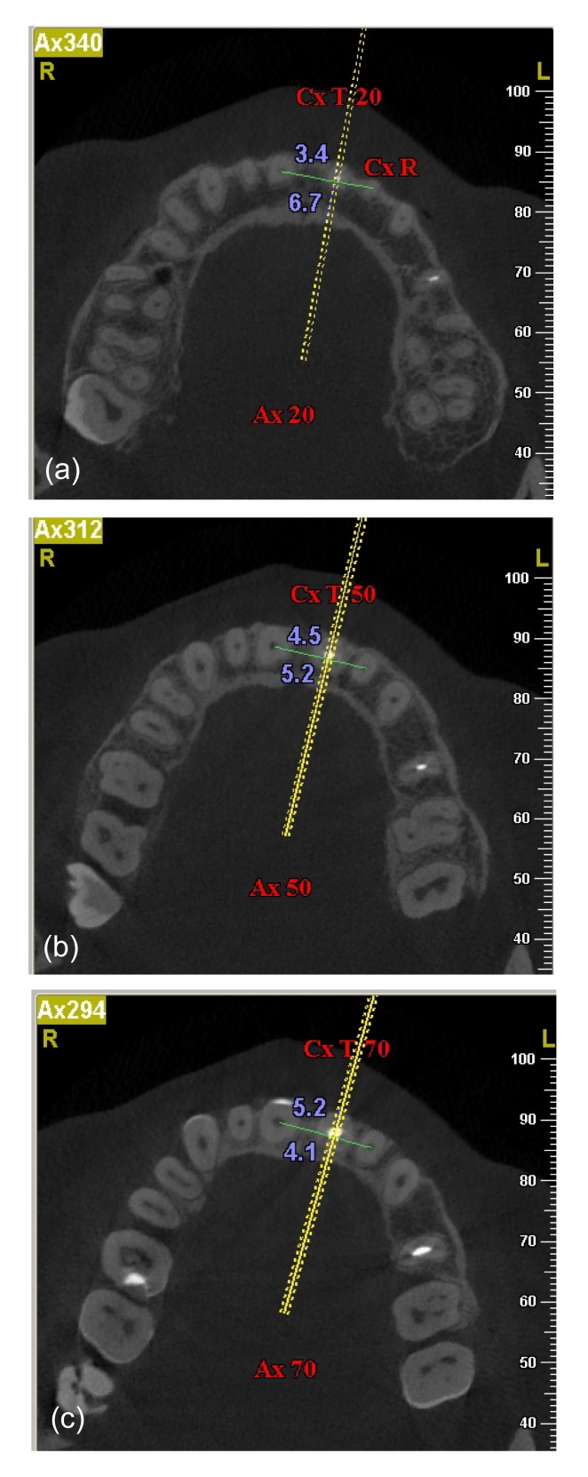 Fig. 3