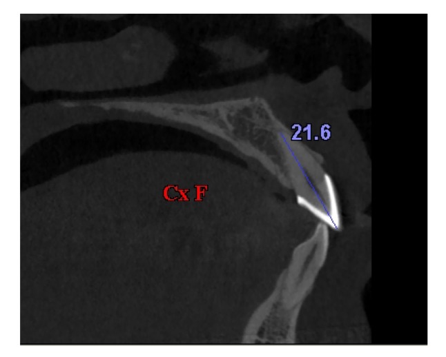 Fig. 10