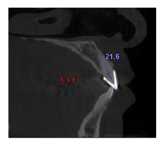 Fig. 6