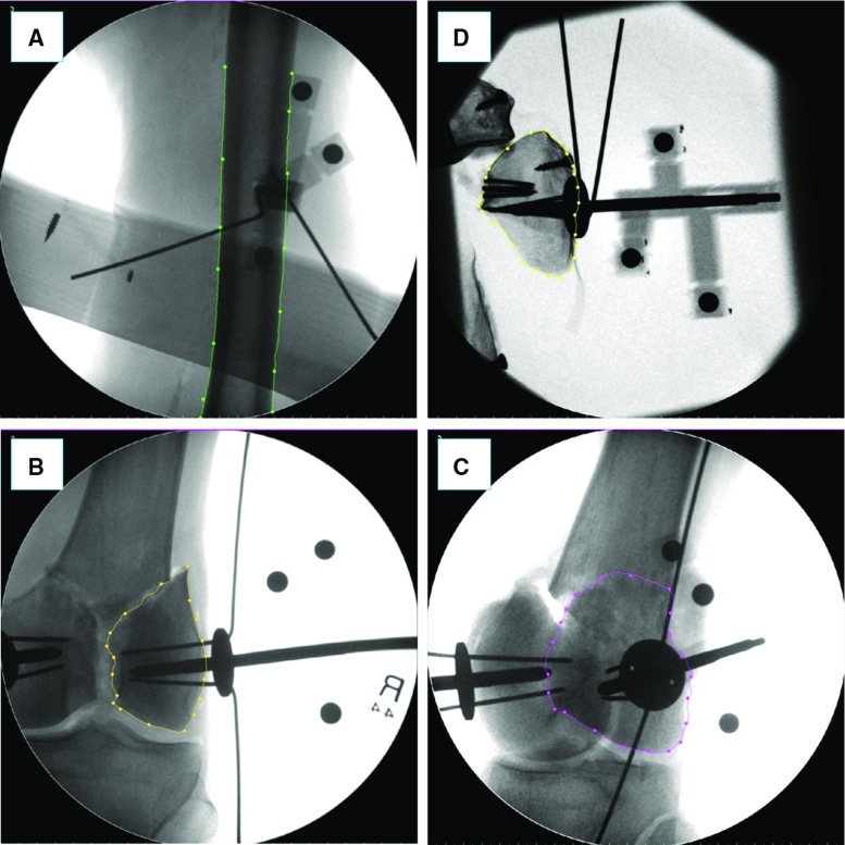 Fig. 10