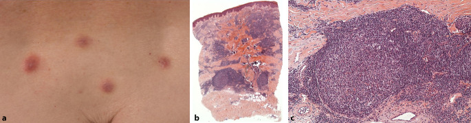 graphic file with name 105_2021_4812_Fig1_HTML.jpg