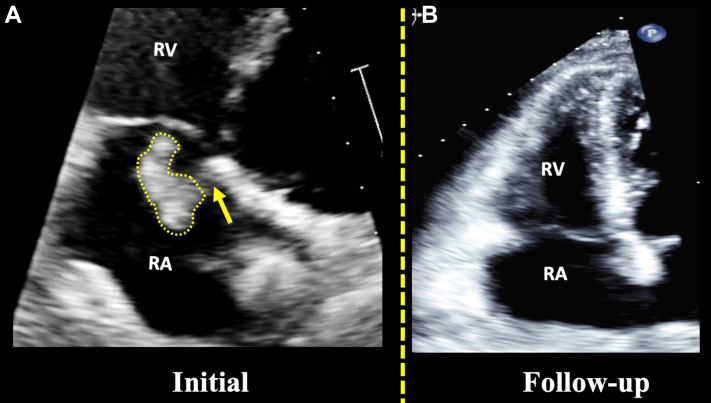 Figure 2