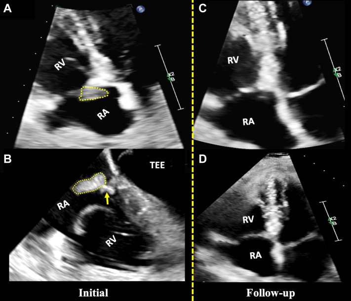 Figure 3