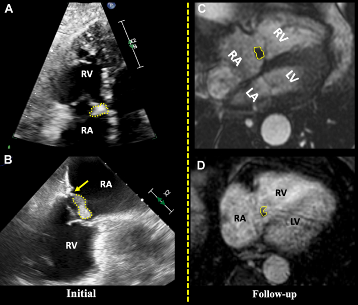 Figure 4