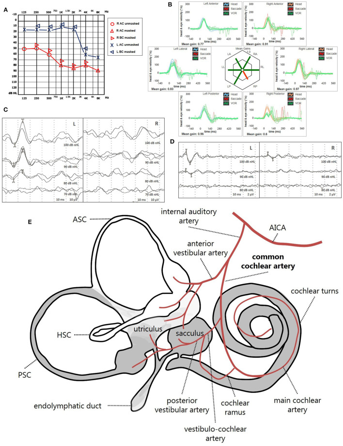 Figure 12