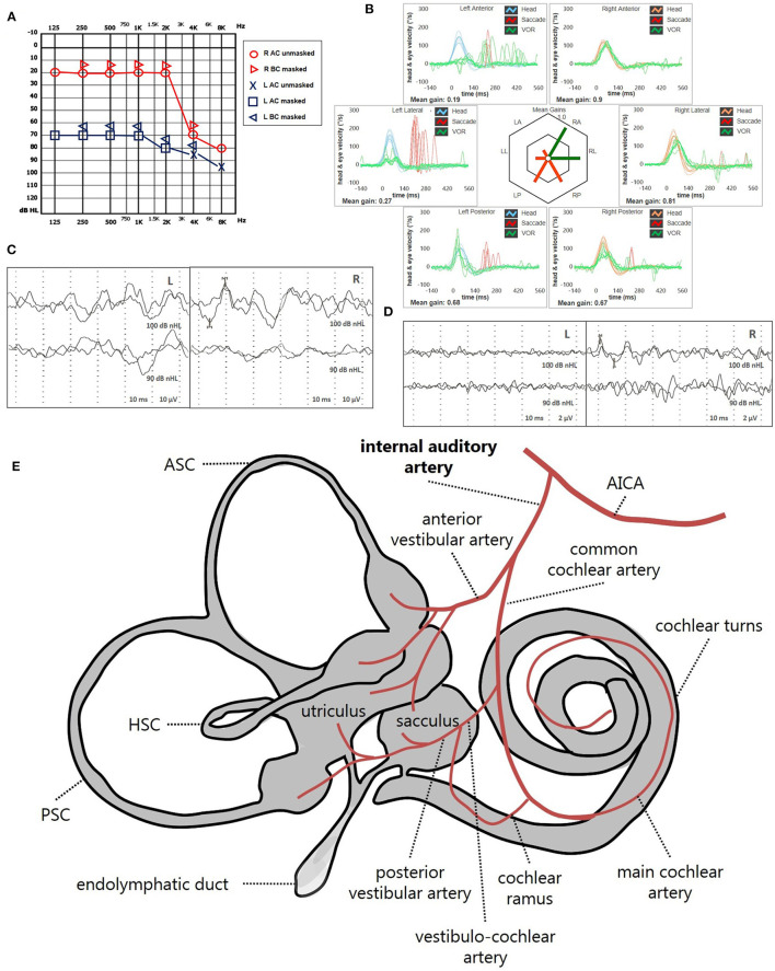 Figure 13